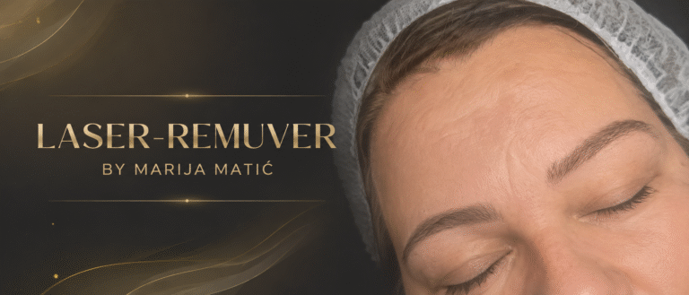 LASER-REMUVER